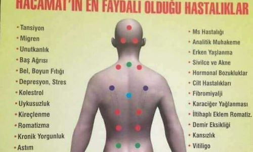 Hacamat | 0 546 774 48 31