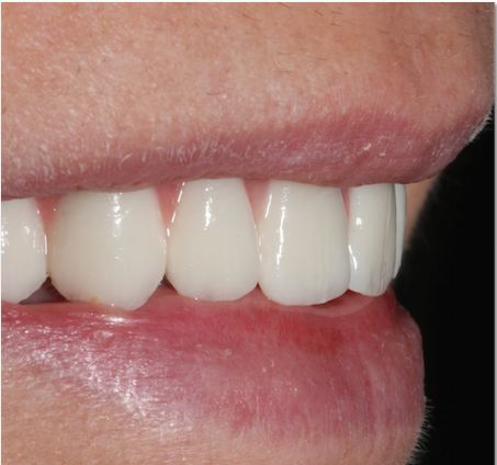 Estética dental