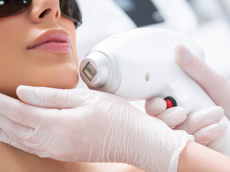 The Benefits of Laser Hair Removal for Acne: Achieve Clear, Glowing Skin