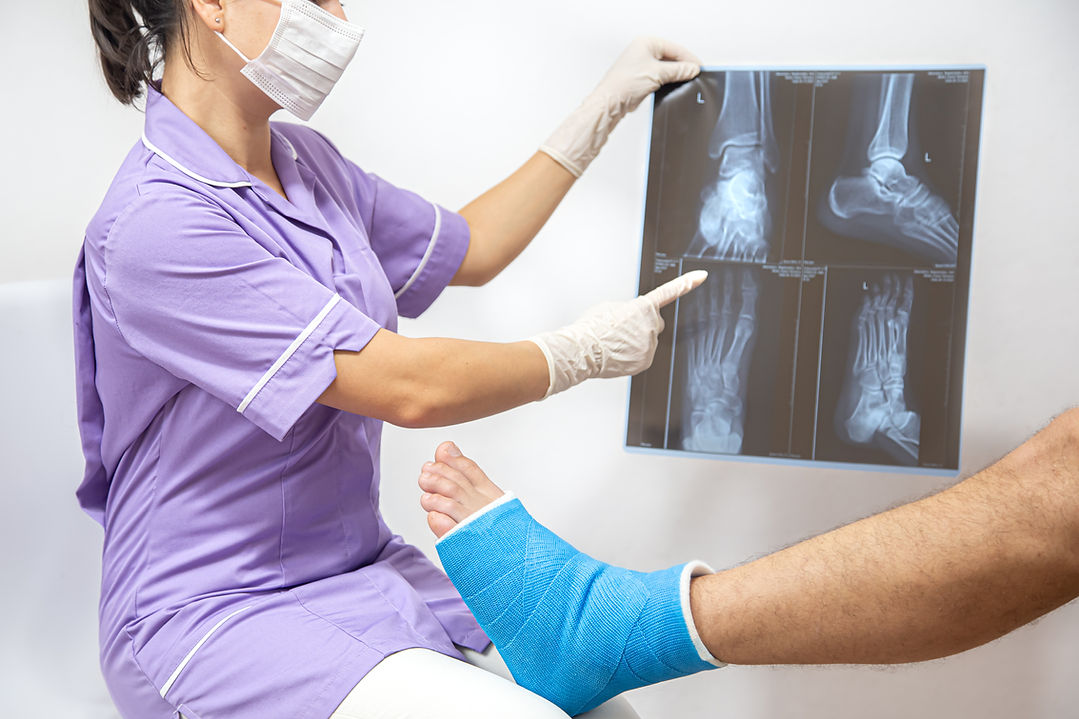 piede-e-gamba-di-frattura-ossea-sul-paziente-maschio-che-viene-esaminato-da-un-medico-donn