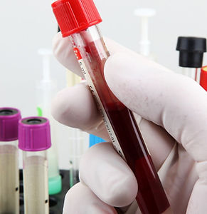 Progetto senza titolo (1).jpg