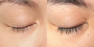 Overnight Lash Daily Use

30 Days
(1 of 2)