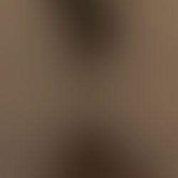 StairVideo