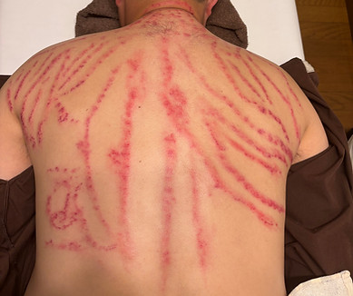 Before and After Treatment Example