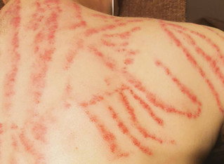 倉敷なおる整体