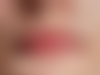 Understanding Your Acne: A Skin Chic Guide