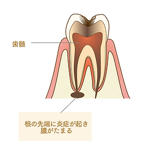 ペル
