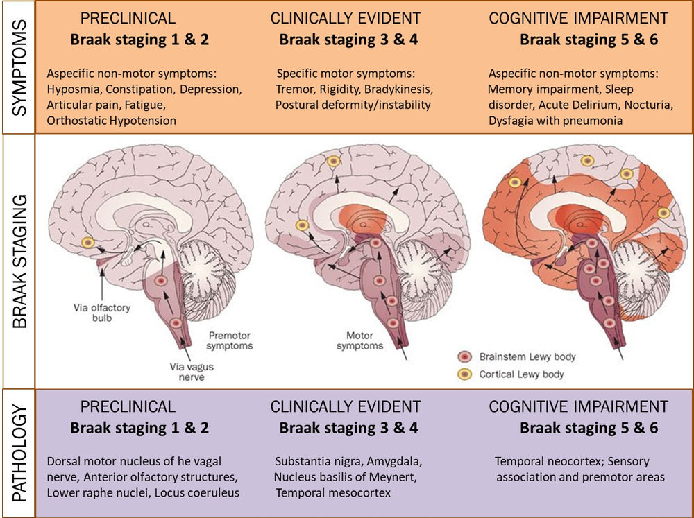 Parkinson's Disease Pathway