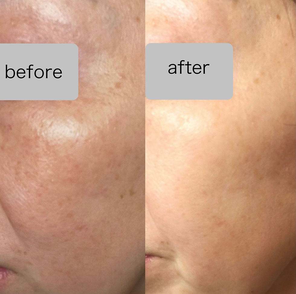 集中ケアコース