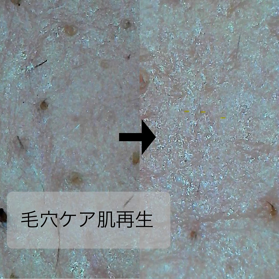 ⭐︎毛穴ケア肌再生⭐︎