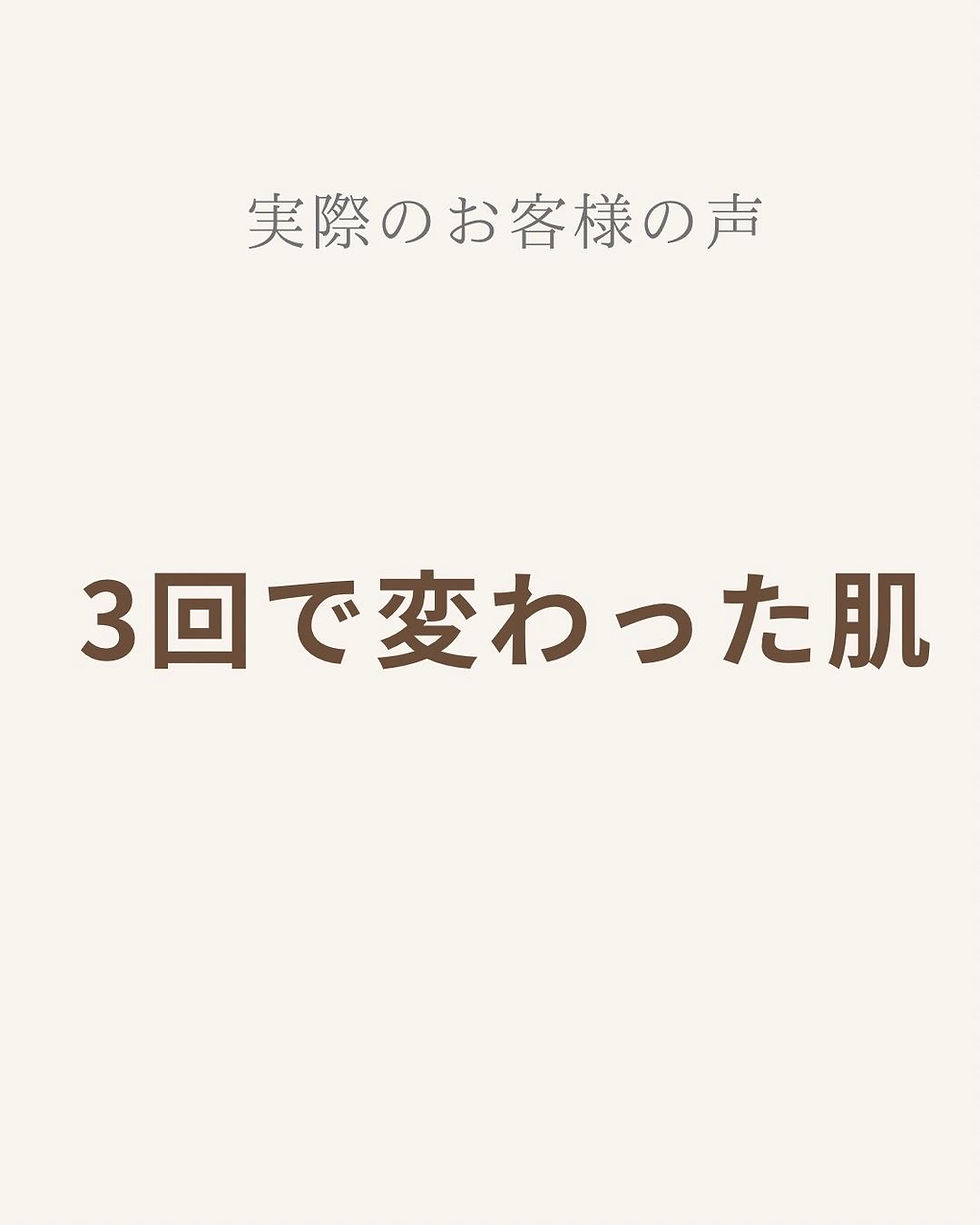 【流山市 シミ改善】「肌、明るくなった?」と友人に言われた50代女性のお客様の声