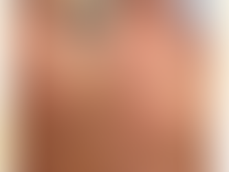 **シミ改善フェイシャルエステ*変化*集中ケア*