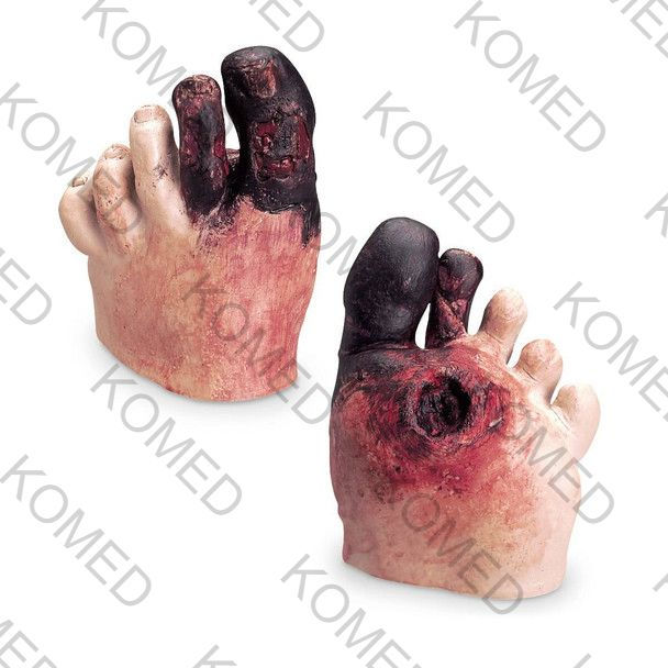 Unhealthy Foot Care Kit
