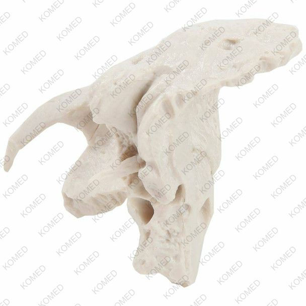 Thumbnail: Temporal Bone