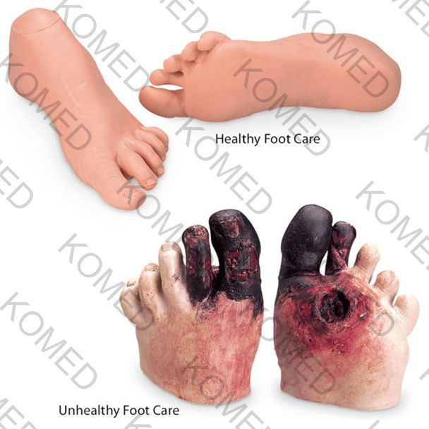 Healthy and Unhealthy Foot Care Set