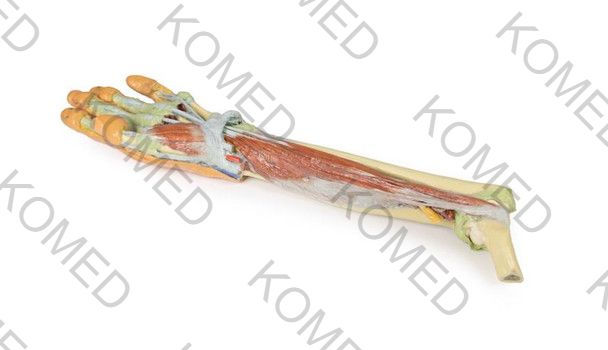 Thumbnail: 3D Printed Deep Dissection - Forearm and Hand
