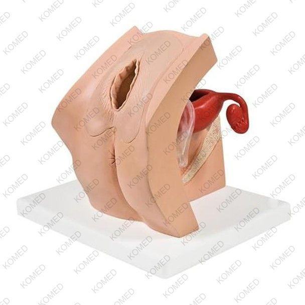 Model for Gynecological Patient Education