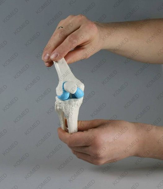 Thumbnail: Knee Implant Model