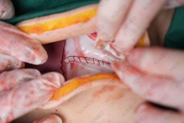 Thumbnail: Komed  Wearable C-Section Simulator