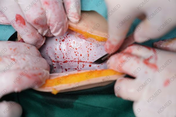 Thumbnail: Komed  Wearable C-Section Simulator