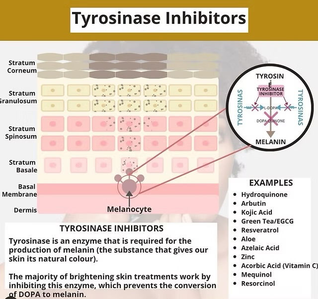 Skin diagram explaining tyrosinase inhibitors used in hyperpigmentation treatment in Atlanta