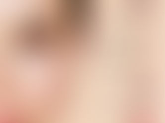 Signs of sun damaged skin including wrinkles and hyperpigmentation treated with microneedling in Atlanta