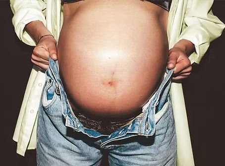 Pregnant woman holding her belly while discussing laser treatments during pregnancy