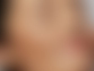 Woman with glowing radiant skin after microneedling treatment in Atlanta.