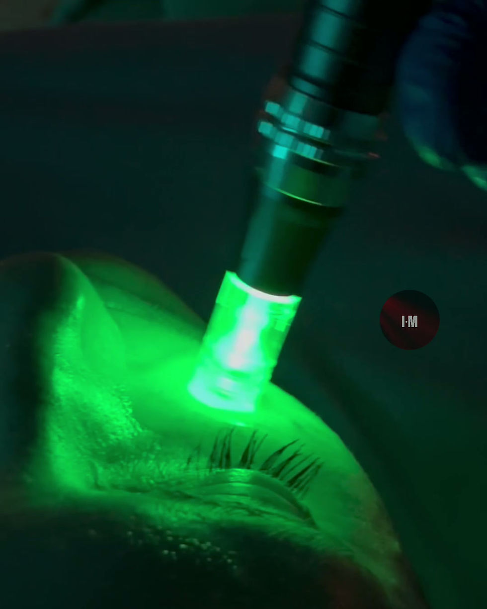 infrared-microneedling-pen-led-treatment-demo.jpg.MOV