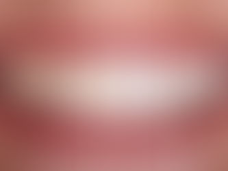 How White Can Teeth Get With Zoom Whitening?