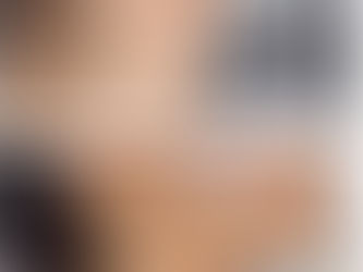 HIFU skin tightening treatment Atlanta double chin lift