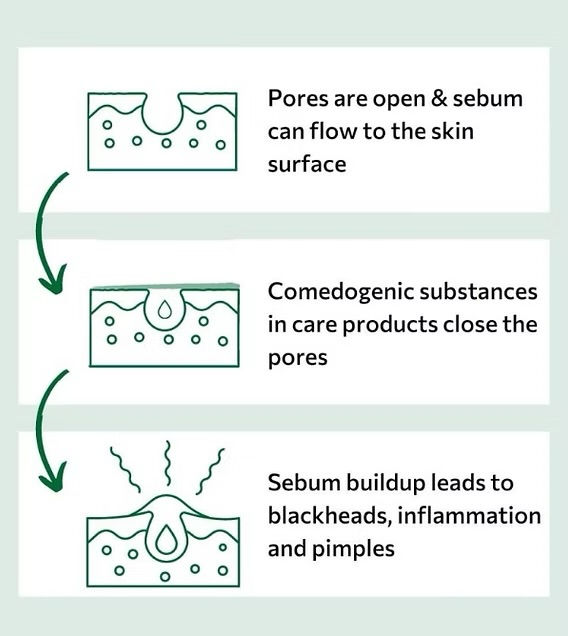 non-comedogenic acne wash by The Mbar Medspa Atlanta