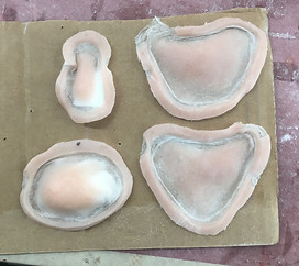 Encapsulated Silicone Facial Prosthetics (Chin,Cheeks,Nose)