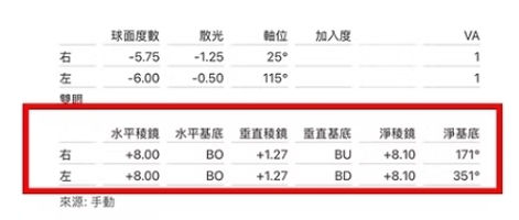 斜視、複視、無法聚焦、有疊影、 稜鏡眼鏡｜視康佳案例分享