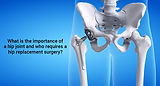 1666095556_What-is-the-importance-of-a-hip-joint-and-who-requires-a-hip-replacement-surger