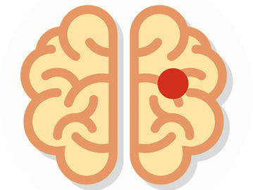 Scientists identify neuroprotective action of metoprolol after stroke