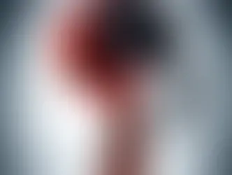 Preventing a secondary stroke is crucial for individuals who have experienced a stroke in the past. 