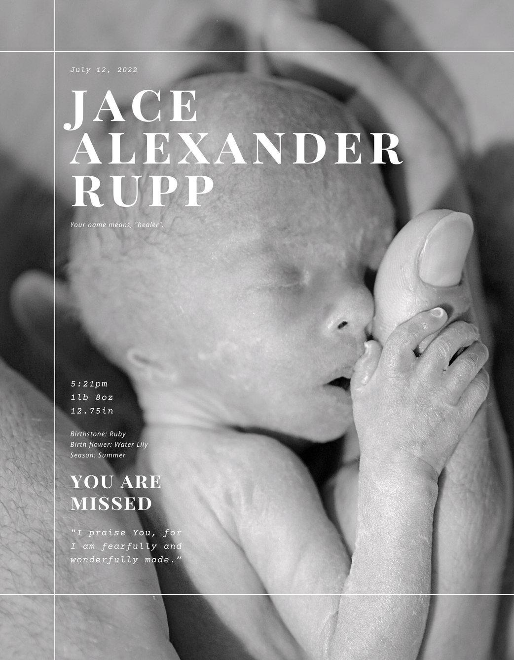 Two pound preemie boy in the palm of his mom's hand