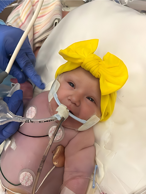 Baby with Bilateral Renal Agenesis diagnosis