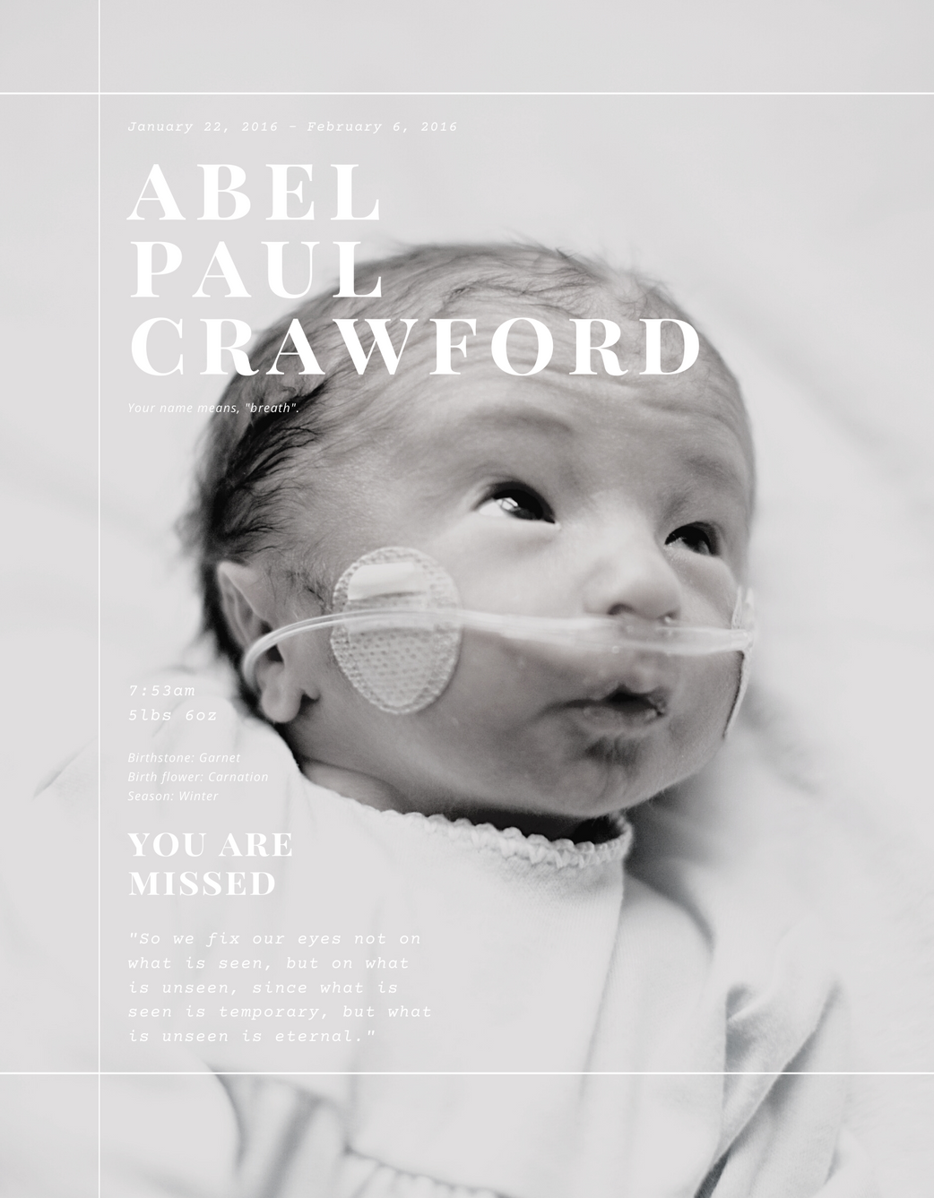 Infant boy with trisomy and breathing tube in his nose