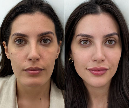 Full Face_edited.jpg