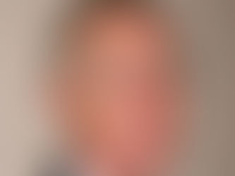 Dr Robert Wolfe | Mastering Liver Health: Exploring Amino Co’s Essential Amino Acids for Fatty Liver