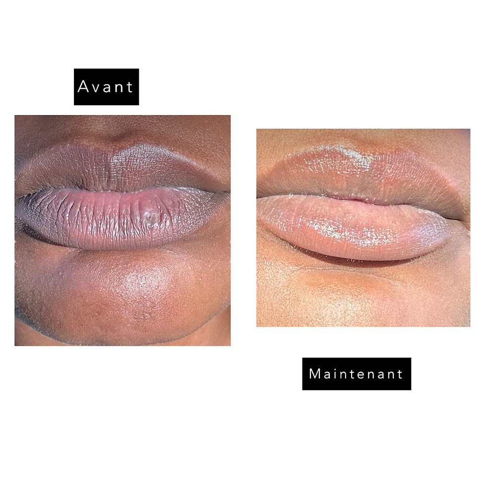 Miniature : Sweet Lips- Baume à Lèvre  éclaircissant- Douceur et Éclat naturel