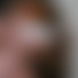 Pourquoi il ne faut pas arrêter sa routine anti acné ou anti taches trop rapidement ?