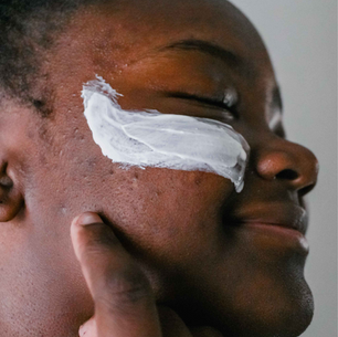 Pourquoi il ne faut pas arrêter sa routine anti acné ou anti taches trop rapidement ?