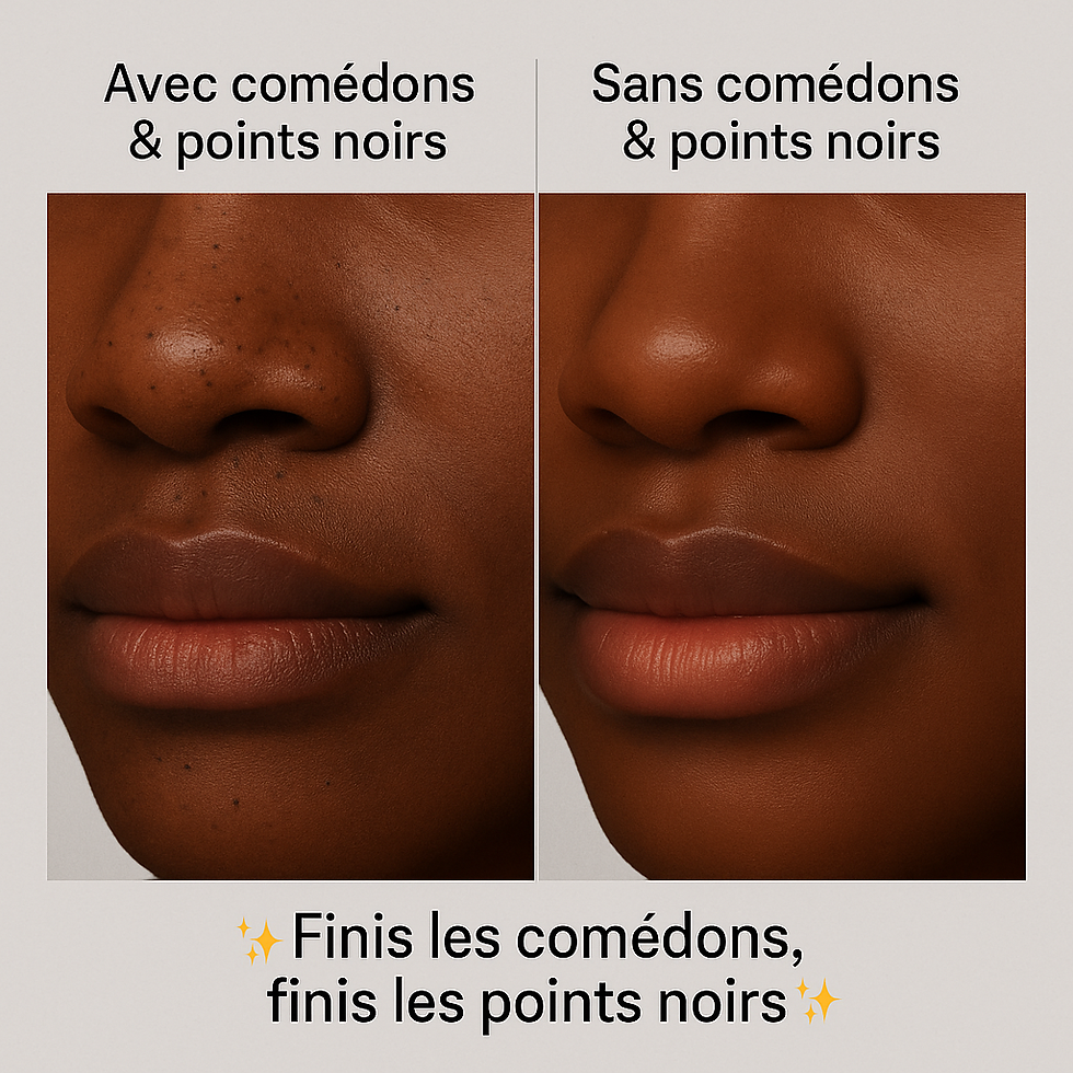 Thumbnail: Comparaison de peau noire avant avec points noirs et après sans imperfections, illustration de la Box Points Noirs & Comédons