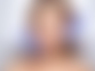 متى تظهر نتائج البوتوكس بدبي؟