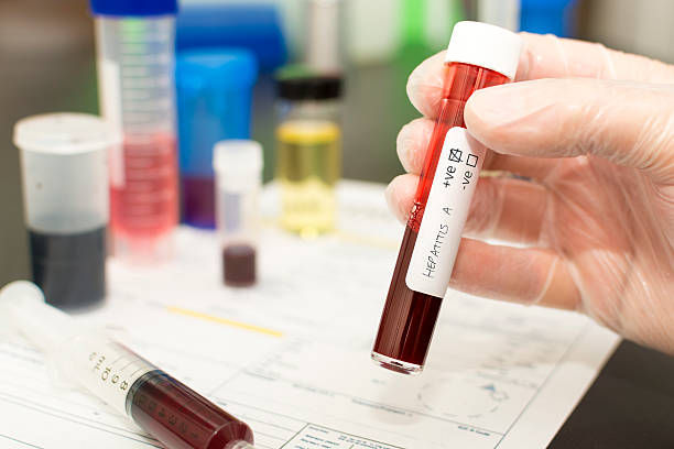 STD Test in Dubai