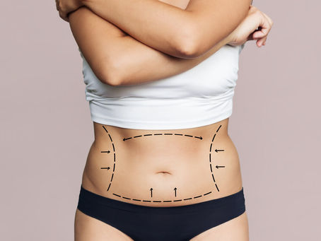 How Tummy Tucks Are Reshaping Beauty Standards in Dubai