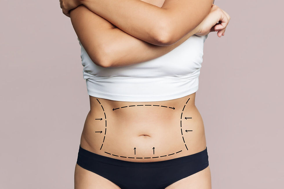 tummy tuck in Dubai